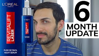 6 MONTH UPDATE LOREAL Revitalift Laser Pure Retinol Overnight Serum [upl. by Ocinom]