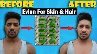 Evion 400  Uses amp Side Effect for Skin amp Hair Routine  100 Results [upl. by Godfry]