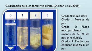 Endometritis Clínica Abordaje y Tratamiento [upl. by Jamaal]