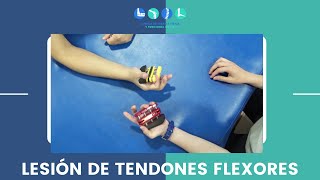 Qué debo hacer si sufrí una lesión de tendones flexores de la mano [upl. by Vial]