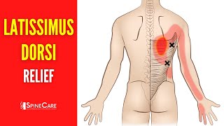 How to Fix Latissimus Dorsi Muscle Pain FOR GOOD [upl. by Ettenwahs846]