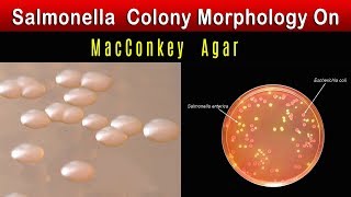 Salmonella Colony Morphology On MacConkey agar [upl. by Neelyad81]