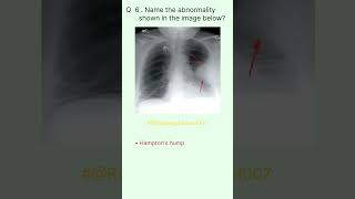 Radiology Buzz 6 radiologychannel007 [upl. by Hameean]