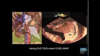 Longitudinal EUS  Anatomical Guiding Structures in the Upper Abdomen Cranial  Left [upl. by Notsob537]