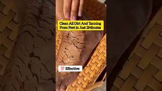 🔥Get Fair Feet in 5MinutesRemove Suntan Easily At HomeEasy pedicureskincare shorts viralvideo [upl. by Ehctav]