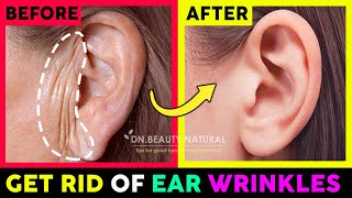 👂6 Mins Get rid of Ear Wrinkles Earlobe Creases  Get Young amp Beautiful ears  Exercise amp Massage [upl. by Anitrak]