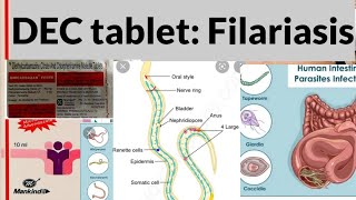 Drug For Filariasis DEC  Diethylcarbamazine and Antihistamine CPM [upl. by Quar]