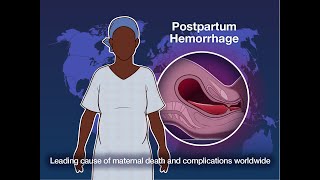 PPH Management  Postpartum Hemorrhage Management  Nursing Lecture [upl. by Ainesy]