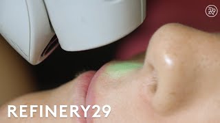 I Got Laser Hair Removal For The First Time  Macro Beauty  Refinery29 [upl. by Buzz]