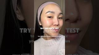 What does your pinch test show darkcircles eyebags eyecream pigmentation skincaretips [upl. by Emyle]