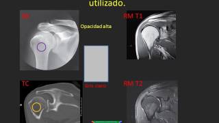 Órganos su visualización por método [upl. by Silletram]