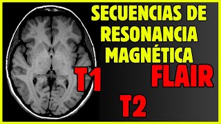 🤯Secuencias de RESONANCIA MAGNÉTICA  ¿Cómo diferenciarlas [upl. by Holihs260]