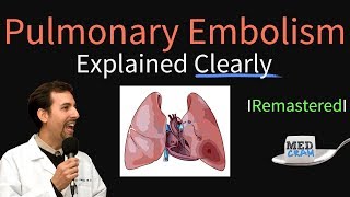 Pulmonary Embolism Remastered  Pathophysiology Symptoms Diagnosis DVT [upl. by Nitnelav]