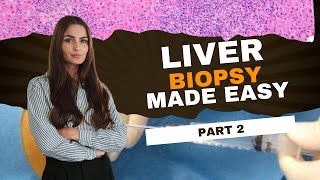 Liver Biopsies Diagnosis made easy  Case Discussion  Part 2 [upl. by Airot]