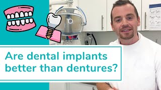 DENTAL IMPLANTS VS DENTURES Whats better [upl. by Guilbert]