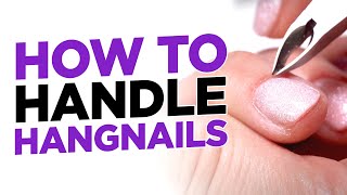 How to Safely Handle Hangnails [upl. by Euphemiah]