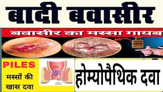 Piles Badi BawasirMasse wali Piles ki homeopathic Dwapiles ke SymptomsTreatmentPiles ke lakshan [upl. by Diley729]