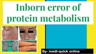 Alkaptonuria and Tyrosinemia  inborn error of protein metabolism [upl. by Eicyak]