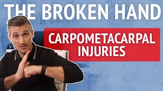 The Broken Hand 2 Carpometacarpal CMC Injuries and bossing in combat sports [upl. by Aitercal]