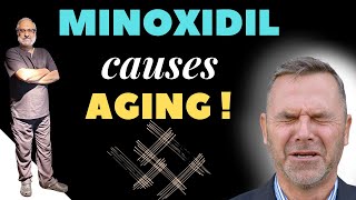 Minoxidil for Hair Loss  Side Effects [upl. by Rhys664]