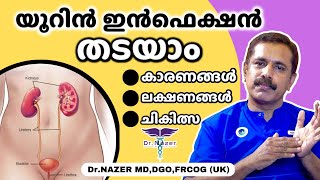 URINE INFECTION UTI MALAYALAM യൂറിൻ ഇൻഫെക്ഷൻ തടയാം  ലക്ഷണങ്ങൾ കാരണങ്ങൾ ചികിത്സ  Dr Nazer [upl. by Nappie]