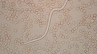 Dirofilaria immitis  microfilaria 400x [upl. by Buatti]