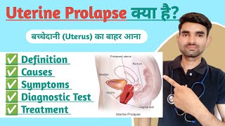 how to treat prolapsed uterus naturally  Uterus Prolapse Exercises In Hindi  बच्चेदानी का बाहर आना [upl. by Ingeborg]