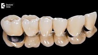 What is difference between composite and GIC cements in dentistry  Dr Harish B [upl. by Neff778]