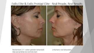 Resultaten Exilis Elite [upl. by Athal]