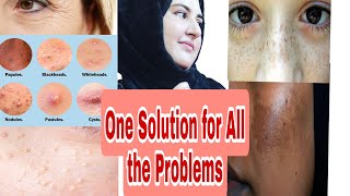 Tretinoin Journey  How To Use Tretinoin For Flawless Skin  Tretinoin Precautions Side Effects [upl. by Trumann]