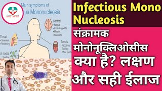 Infectious Mononucleosis MONO संक्रामक मोनो कि बीमारी क्या होती है ईलाज क्या है  पूरी जानकारी [upl. by Marsland]