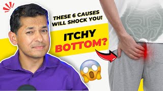 Itchy Bottom These 6 Causes Will Shock You [upl. by Nnalyrehs692]