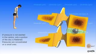 The intervertebral disc [upl. by Nnaid]