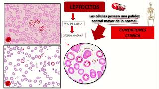 LEPTOCITOS Hematologia [upl. by Karas]