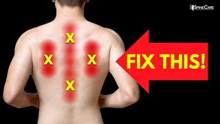 How to Instantly Relieve Nerve Pain in Your Upper Back [upl. by Coe]