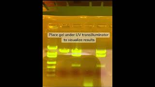 Gel Electrophoresis [upl. by Marolda]