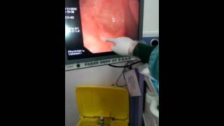 How to perform upper GI endoscopy [upl. by Ericksen]