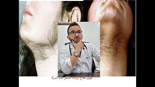 أحسن علاج لزيادة الشعر عند المرأة le meilleur traitement pour lhyperpilosité [upl. by Bbor89]