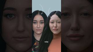 What Happened To Noah Cyrus  Dramatic Face Transformation [upl. by Pearle679]