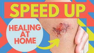 Wound Care How To Heal Faster At Home [upl. by Laekcim]