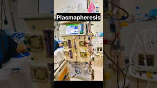 Plasmapheresis With Advanced Dialysis Machine nephrology kidneyhealth kidneydisease ytshorts [upl. by Lamok739]