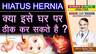 HIATUS HERNIA क्या इसे घर पर ठीक कर सकते है   CAN YOU FIX HIATUS HERNIA YOURSELF [upl. by Almallah]