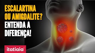 ESCOLAS FECHADAS POR BACTÉRIA ENTENDA O QUE É ESCARLATINA E A DIFERENÇA DA DOENÇA PARA AMIGDALITE [upl. by Lordan]