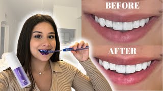 I TRIED THE TIKTOK FAMOUS PURPLE TOOTHPASTE TO WHITEN MY TEETH hismile v34 purple teeth whitening [upl. by Adia30]