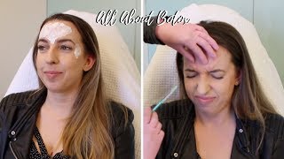 All About Botox 💉 Crows Feet Forehead 11 Before amp After Photos Does It Work Cost Review [upl. by Guido]