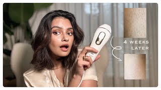 IPL Hair Removal At Home with Braun What I think 15 years later [upl. by Aynatal]