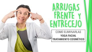 Arrugas Frente y Entrecejo  Yoga Facial  Tratamiento [upl. by Prentice]