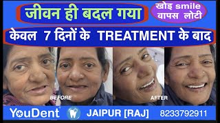 Full mouth dental implant treatment  Best dental implant centre in India Youdent hospital jaipur [upl. by Ausoj445]