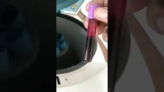 Centrifuge machine plasma separation of blood [upl. by Iron335]