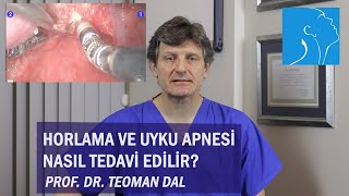 HORLAMA VE UYKU APNESİ NASIL TEDAVİ EDİLİR  PROF DR TEOMAN DAL [upl. by Nylinnej]